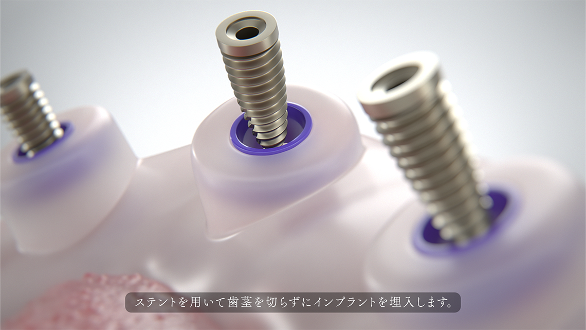 ADCの画像4